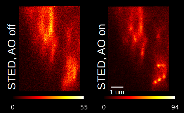 Adaptive optics to improve image quality in fluorescent images of keratin in mouse liver